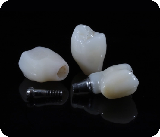 A group of dental implants